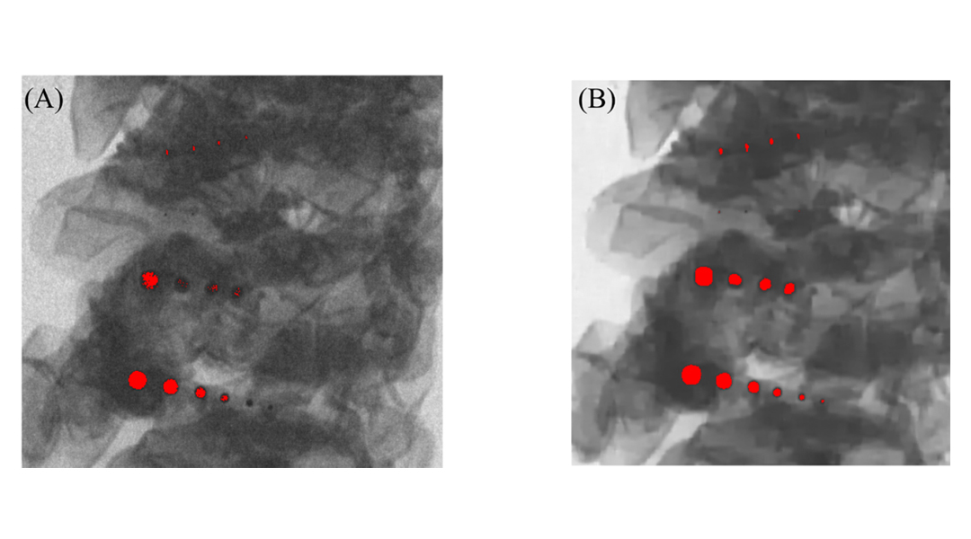Contaminants detection through simple thresholding technique  in raw pork image
