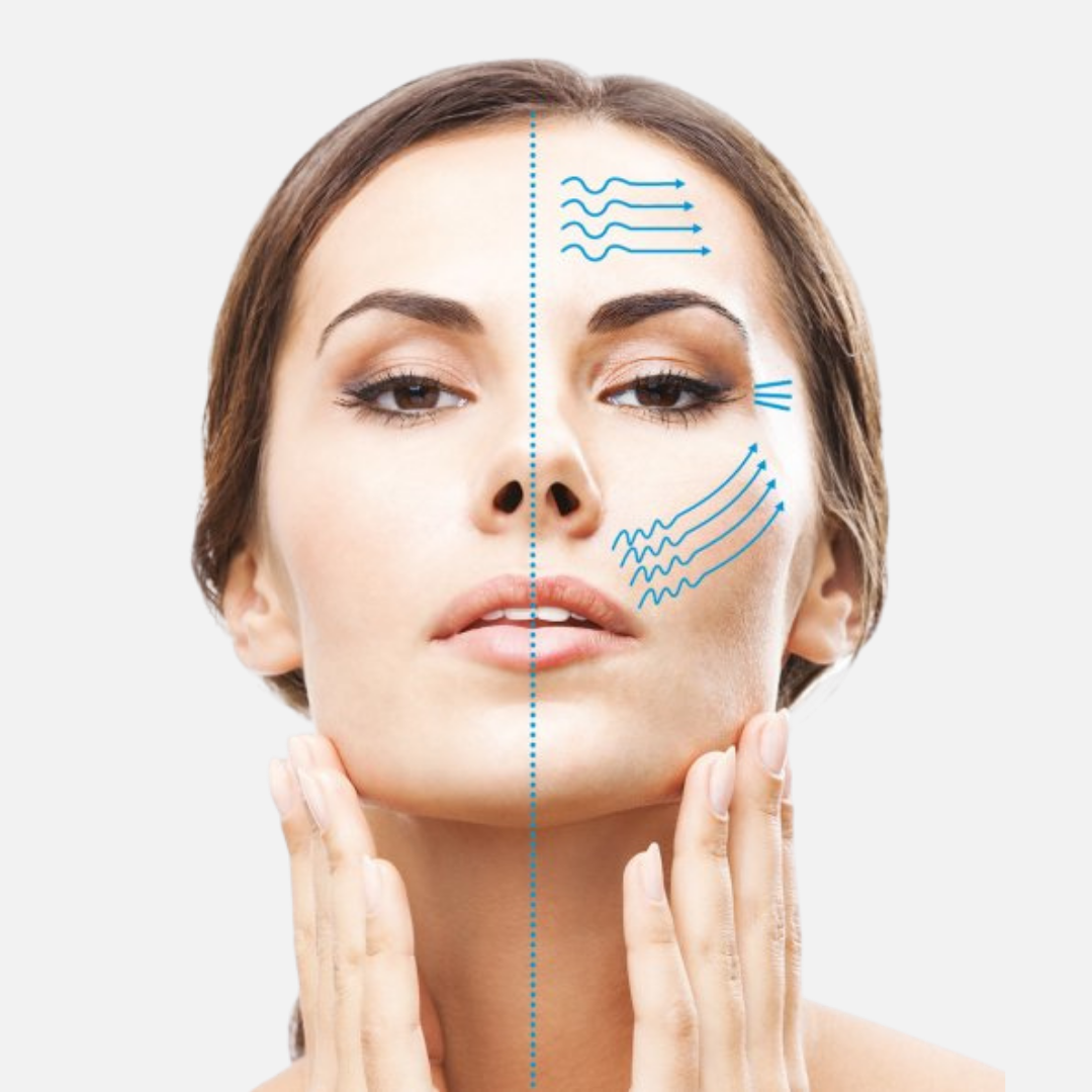 HIFU Non Surgical Face Lift