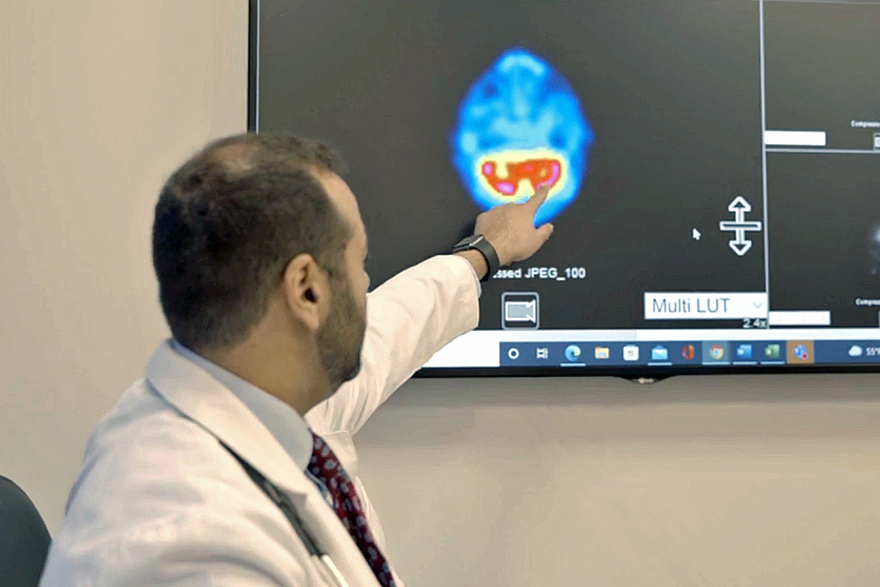 Aviv Doctor Explaining Brain Scan to Client